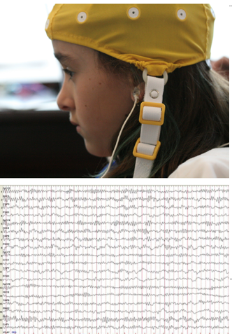 Casque Mitsar jaune sur petite fille avec le tracé des ondes enregistrées pour le bilan de neurofeedback EEGq