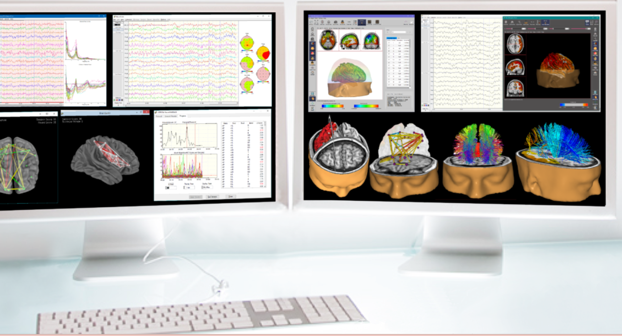 Interface du logiciel NeuroGuide : analyse de l’EEG quantifié et comparaison à la base normative