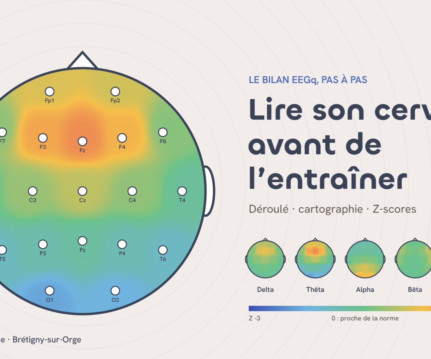 Illustration d’une cartographie EEGq : tête vue de dessus avec les 19 électrodes du système 10-20 et les écarts à la norme en couleurs