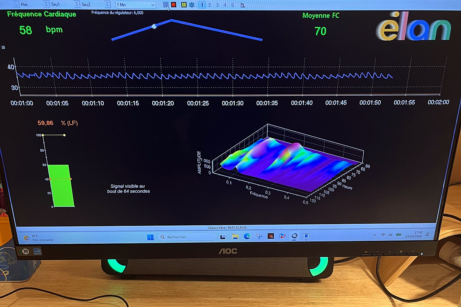 Cardiac biofeedback session: finger pulse sensor and heart rate curve on screen