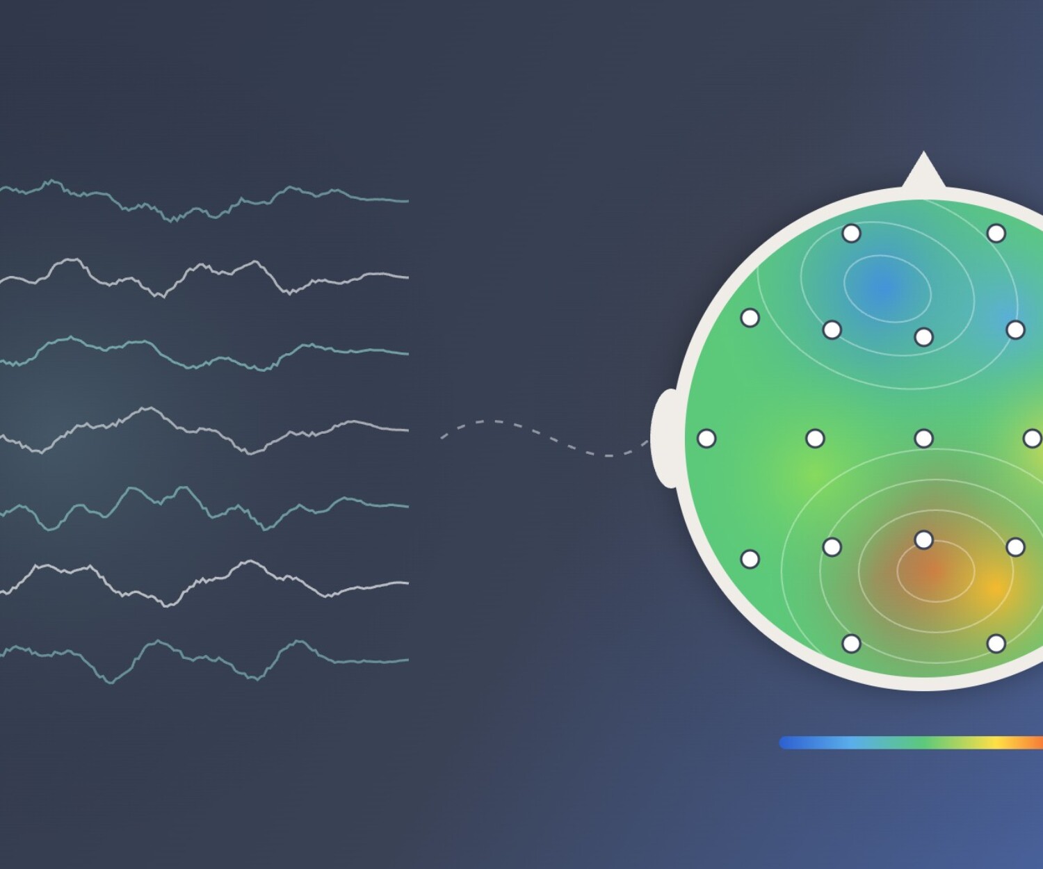 Illustration : tracés EEG et cartographie cérébrale EEGq avec les 19 électrodes, pour comparer neurofeedback dynamique et neurofeedback guidé par EEG quantifié