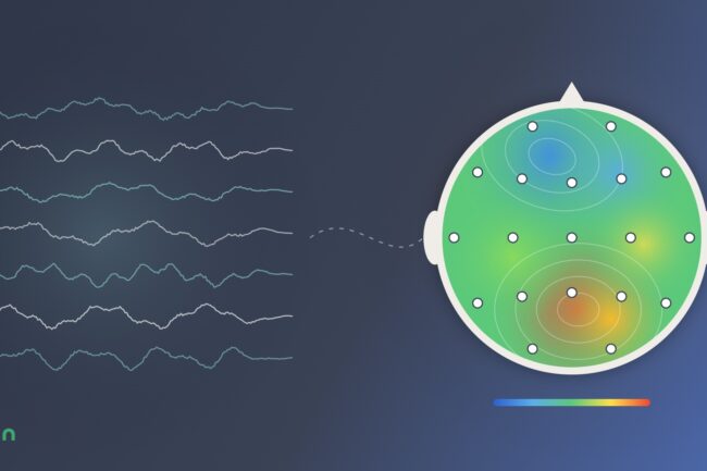 Illustration : tracés EEG et cartographie cérébrale EEGq avec les 19 électrodes, pour comparer neurofeedback dynamique et neurofeedback guidé par EEG quantifié